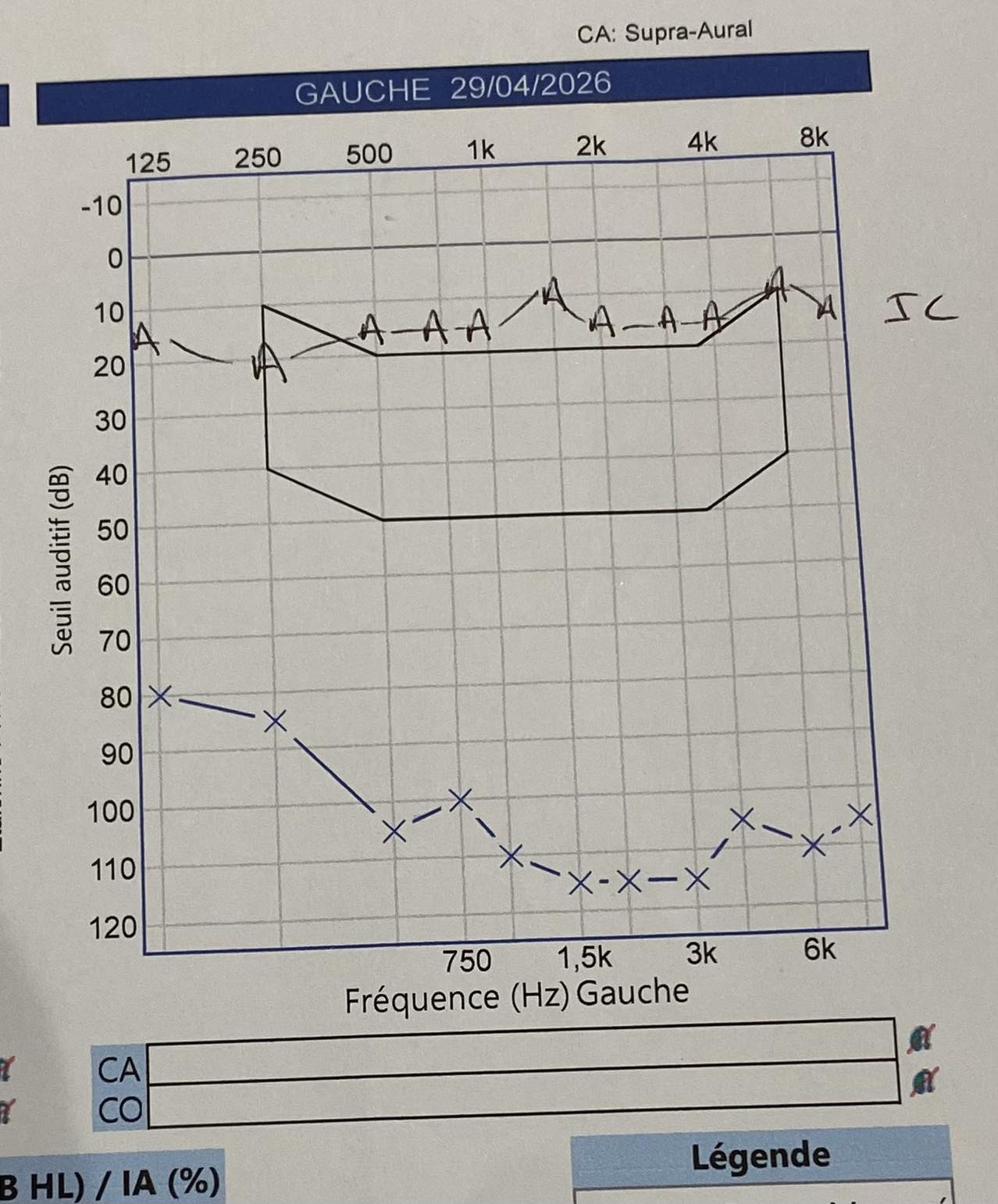 Audiogramme